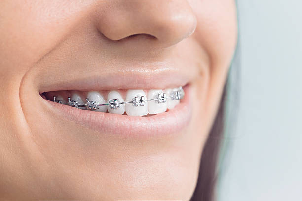 Best Traditional Braces  in Arcola, IL